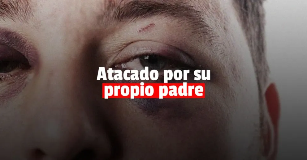 Un anciano golpeó y lesionó a su hijo adolescente