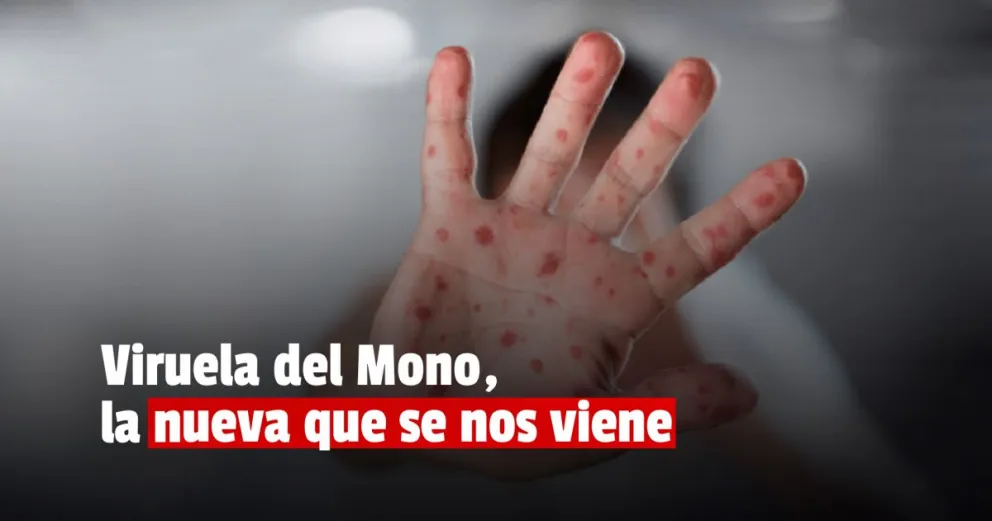 Viruela del Mono, la nueva enfermedad que está causando alarma en el mundo