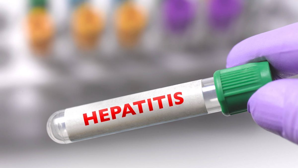 Recomendaciones sobre la hepatitis aguda grave de origen desconocido