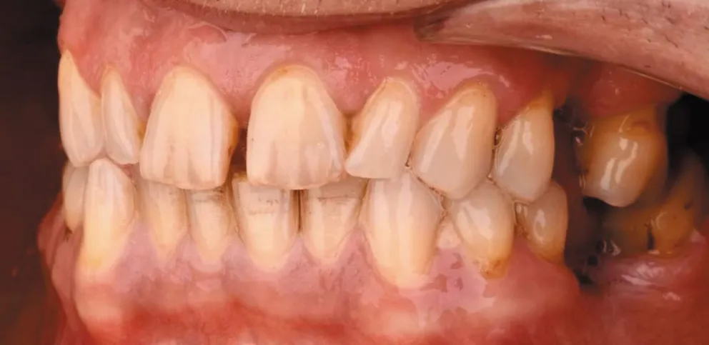 Cambiando la imagen bucal