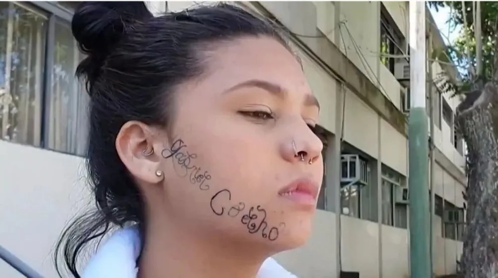 Aberrante: su expareja la secuestró y le tatuó su nombre en la cara para marcarla como “su propiedad”