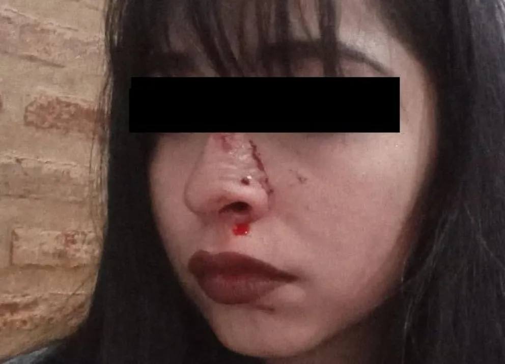 Una joven denunció una brutal paliza cuando iba a un after