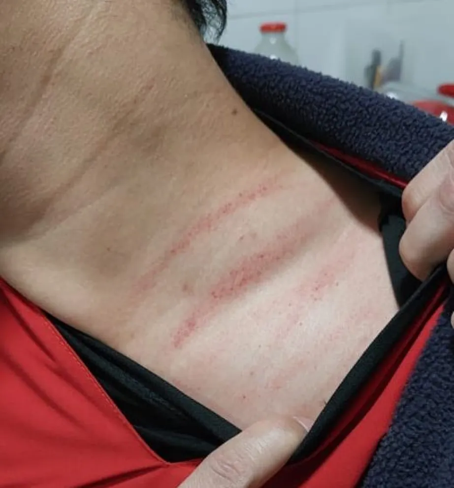Un enfermero del Hospital fue agredido y ATE reclama presencia policial permanente