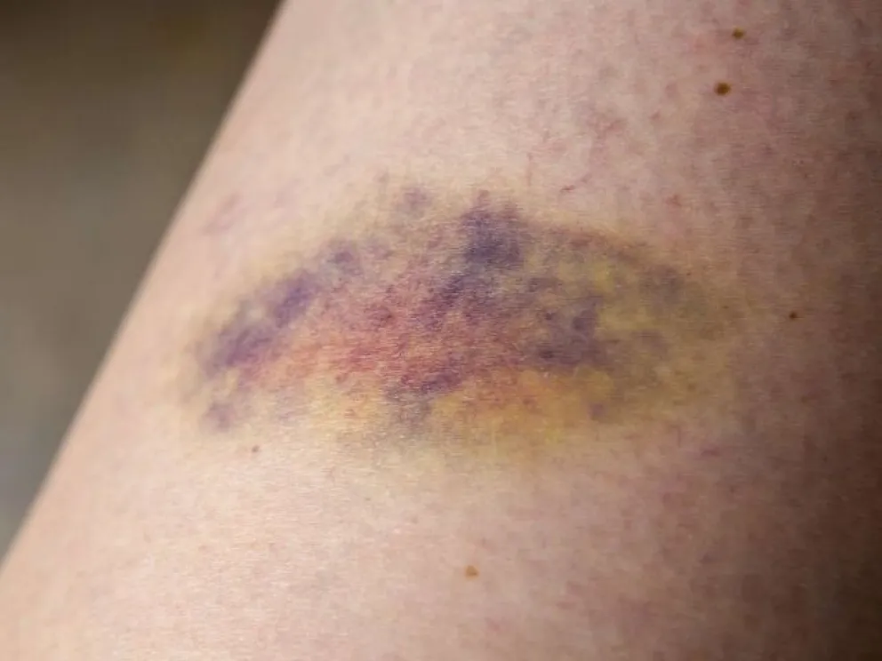 Se levantó con el pie izquierdo y se descargó golpeando al padre 