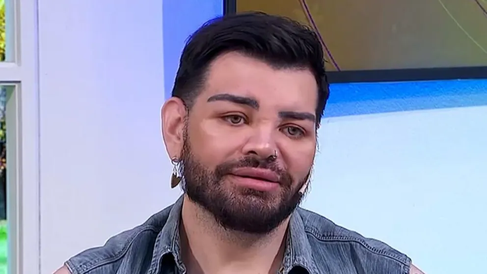 Se hizo más de 30 cirugías para parecerse a Ricky Martin: “Quedé más lindo que él”