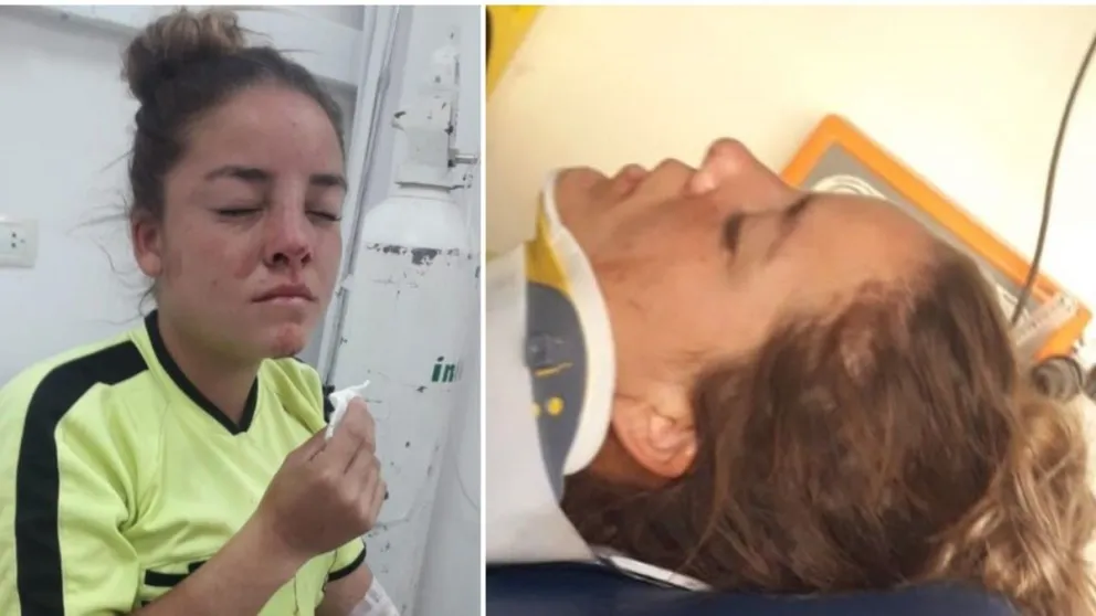 Video: jugadora terminó detenida tras golpear a una mujer árbitro y mandarla al hospital
