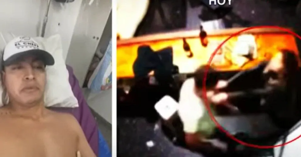 Un joven denunció que su novia lo apuñaló por celos