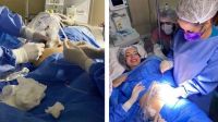 Médicos quemaron el tumor de un bebé en el útero para salvar su vida