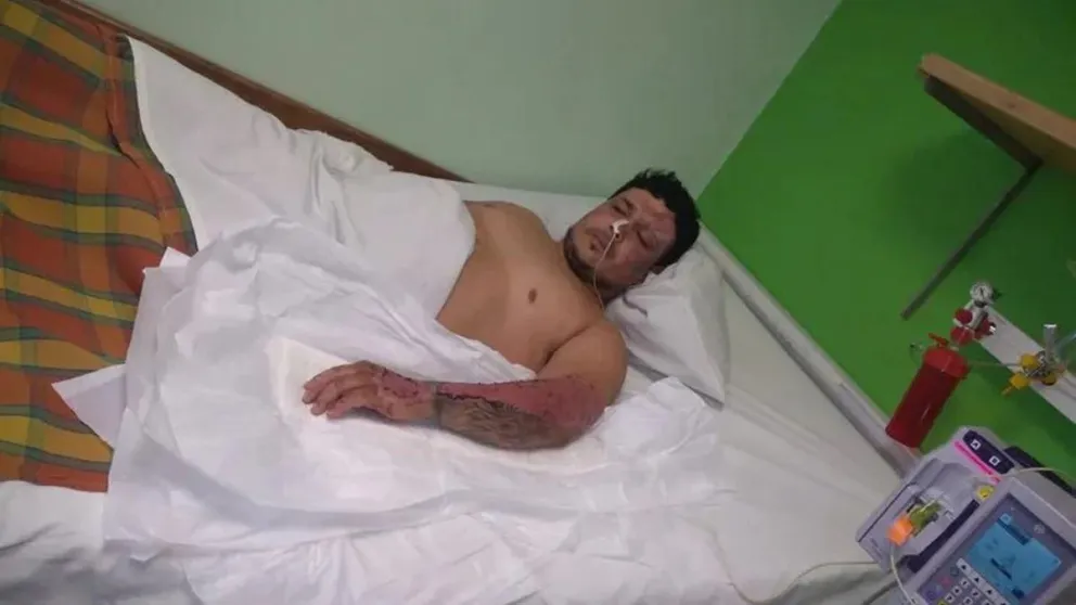 Tristeza total: un hombre perdió lo más importante de su vida en un incendio