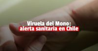 Chile declaró alerta sanitaria tras confirmar seis casos de Viruela del Mono