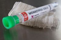 Chile declaró alerta sanitaria por la viruela del mono