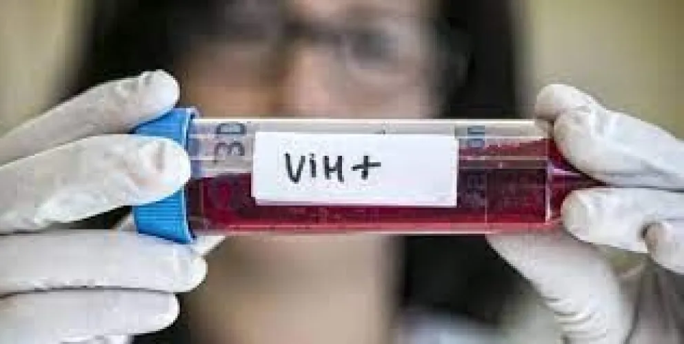 Este lunes se realizarán tests gratuitos de VIH en distintos puntos de la provincia de Salta: Enterate donde