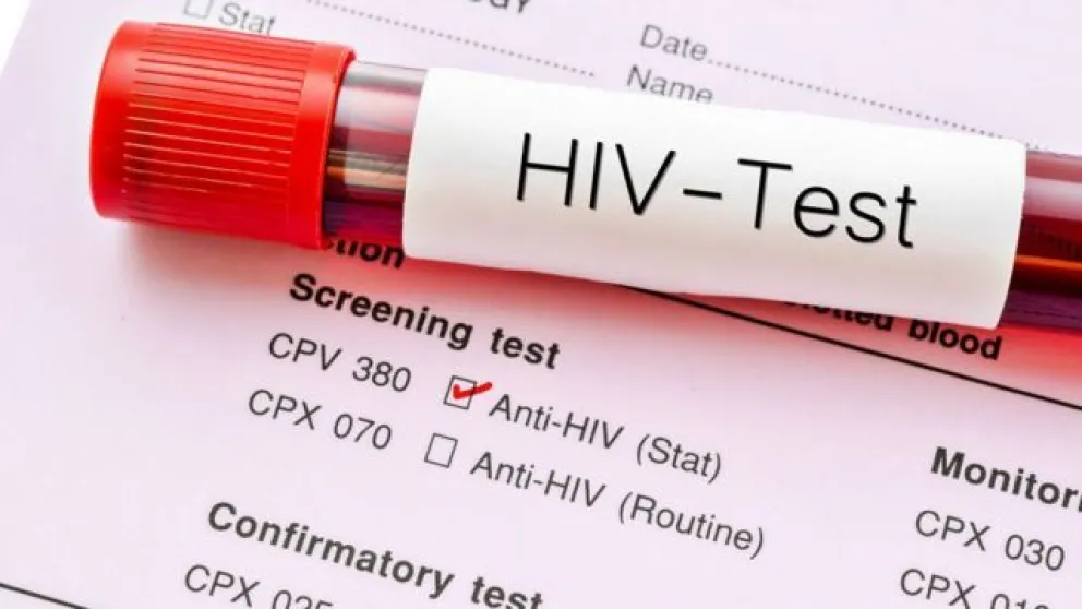 Día Nacional de la prueba del VIH: cómo testearse en segundos