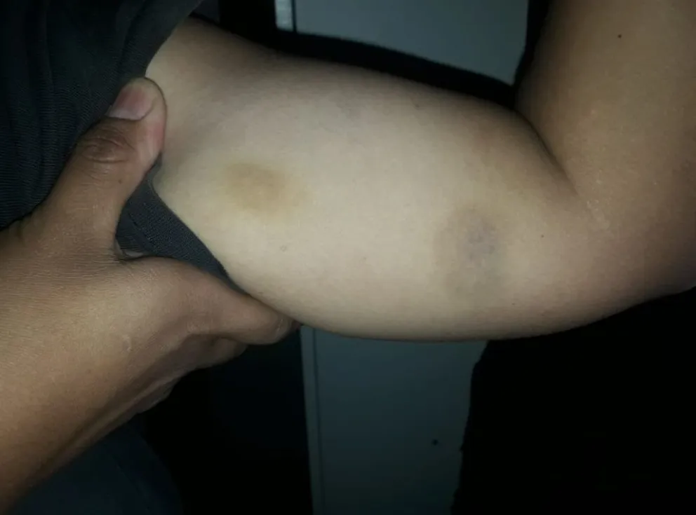Fútbol femenino: hubo una pelea, la víctima golpeada no siguió en la justicia y la causa fue al archivo