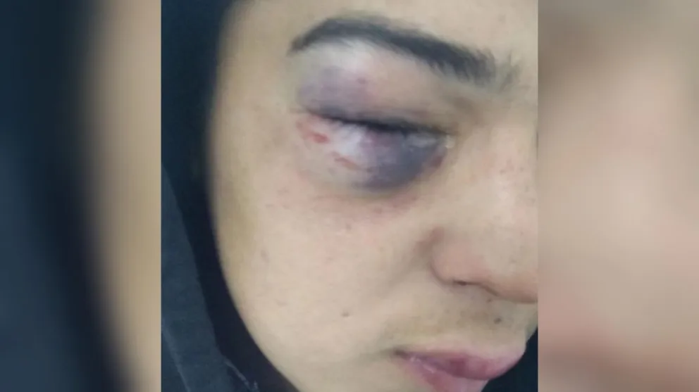 Denuncian a un patovica de un boliche de Patagones, por una severa paliza